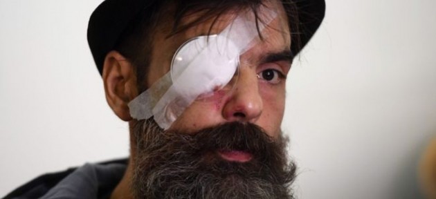 Polis şiddeti: Sarı Yelekliler’in lideri gözünü kaybetti