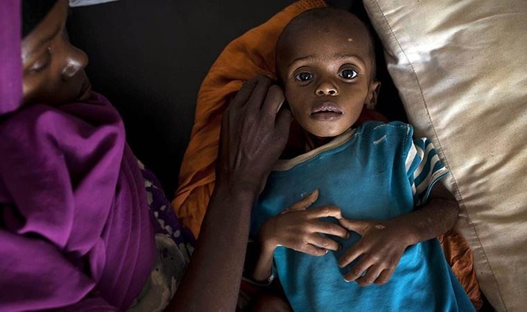 BM: Burkina Faso'da yarım milyon çocuk açlık sınırında